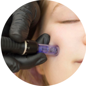 Microneedling Dr Pen